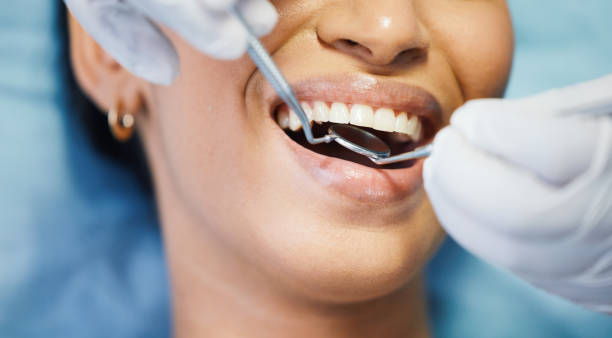 Best Emergency Treatment for Oral Infections in Hollister, CA
